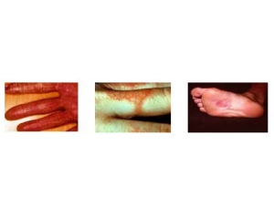 Ni releases檢測(cè)|鎳釋放量檢測(cè)